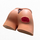 Simulador región sacra y glúteos con lesiones por presión  1