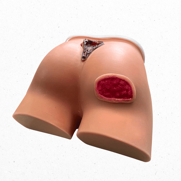 Simulador región sacra y glúteos con lesiones por presión  1