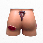 Simulador región sacra y glúteos con lesiones por presión  3