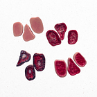 Simulador región sacra y glúteos con lesiones por presión  4