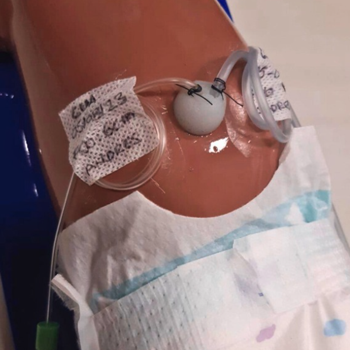 Simulador Colocación de catéter umbilical 4