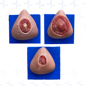 Simulador de ulceras por presión GII GIII GIV