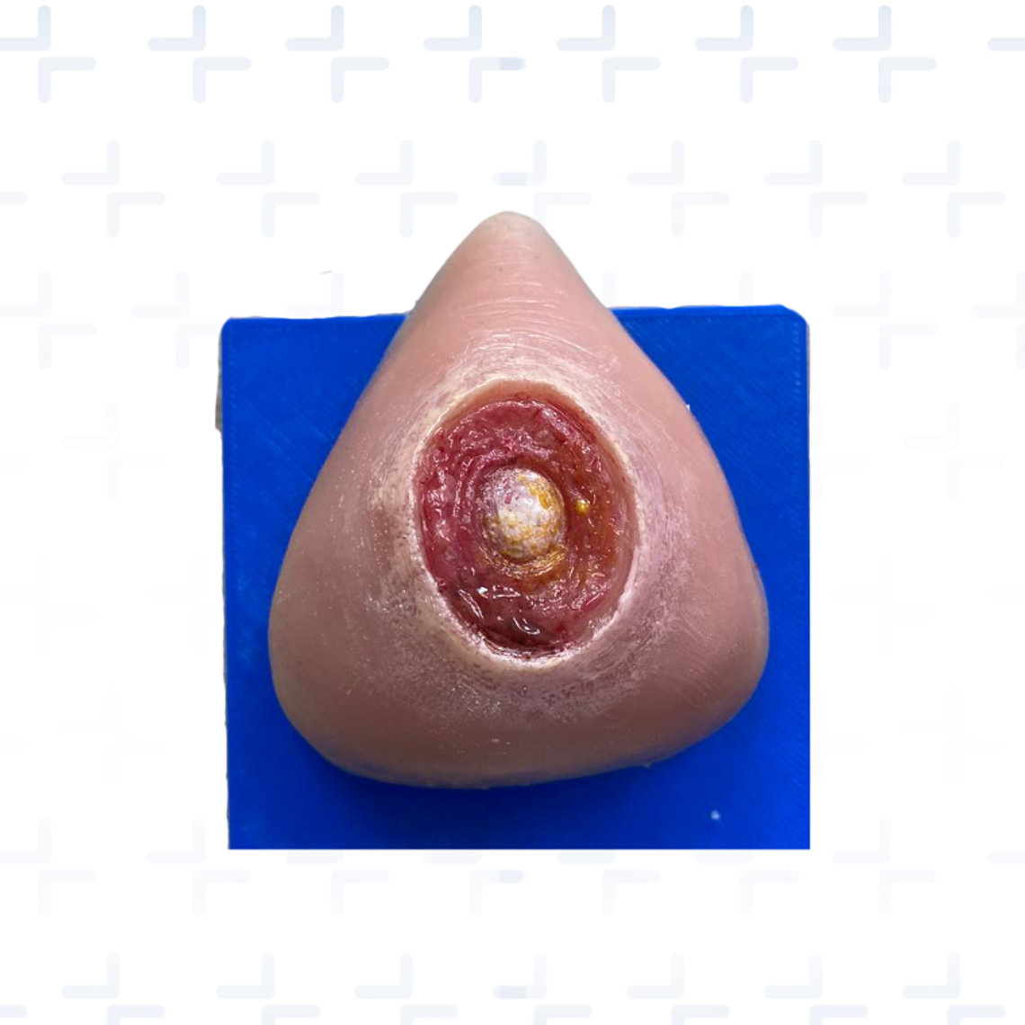 Simulador de ulceras por presión GII GIII GIV 2