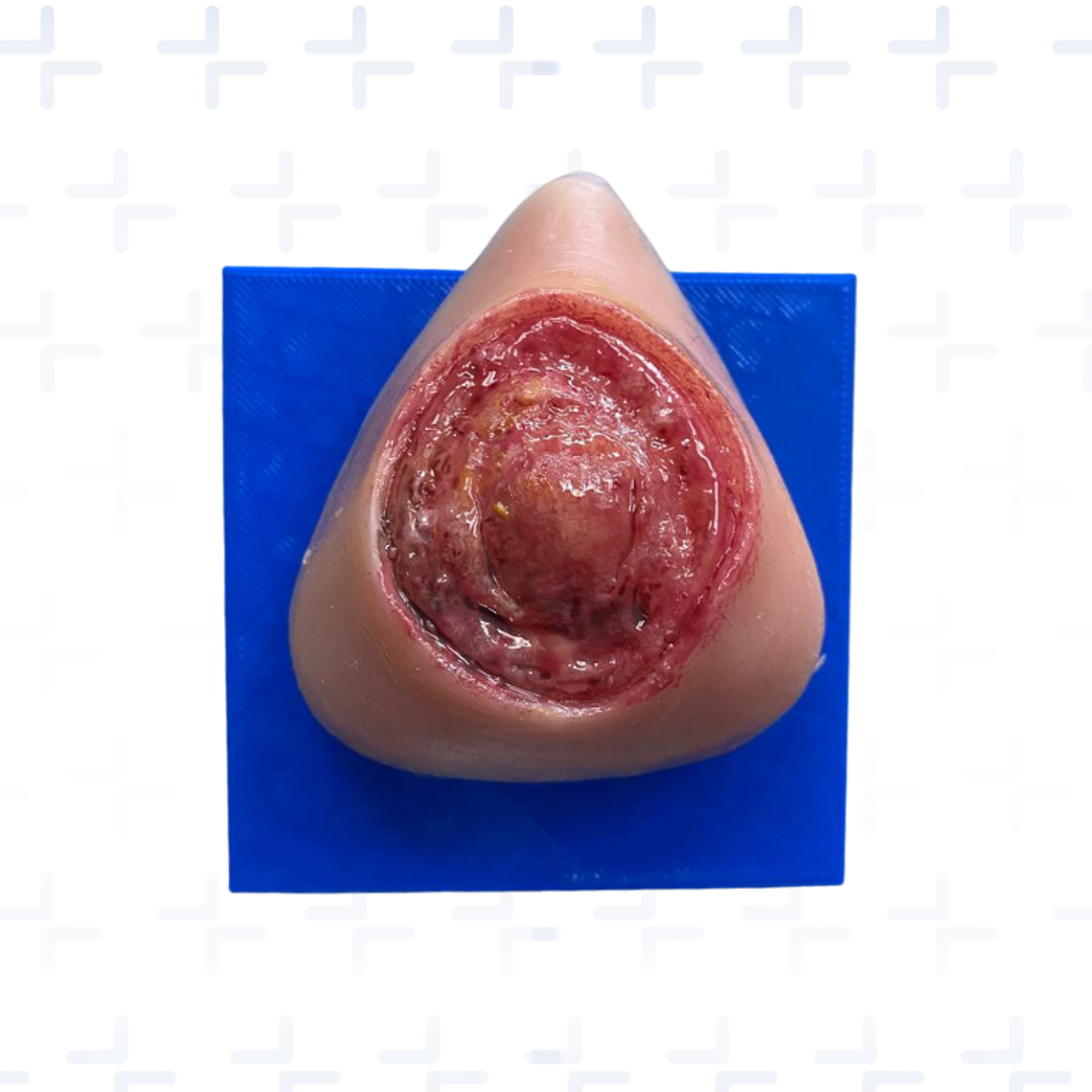 Simulador de ulceras por presión GII GIII GIV 3