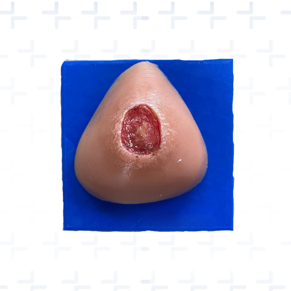 Simulador de ulceras por presión GII GIII GIV 4