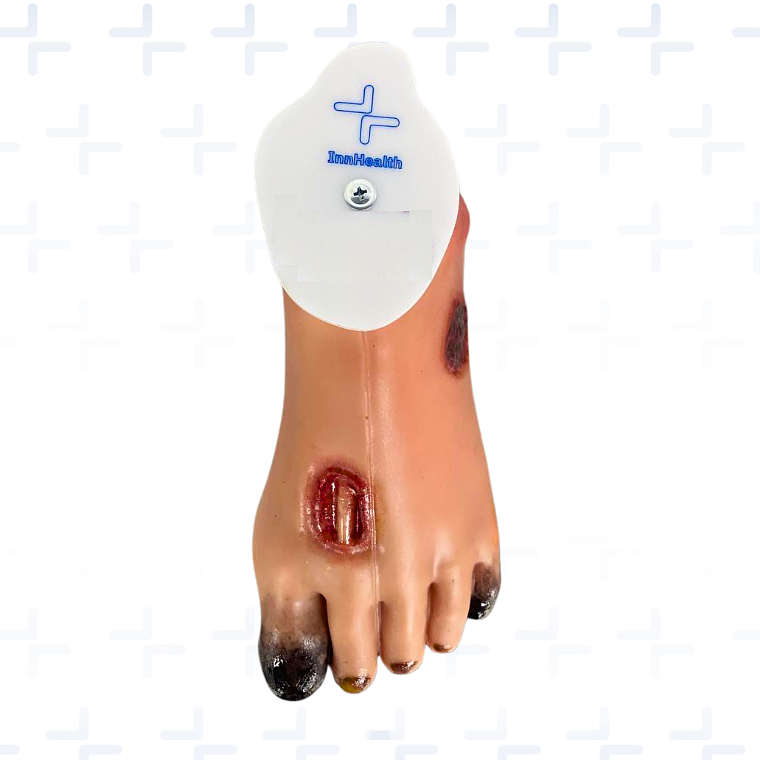 Simulador de pie diabético  2