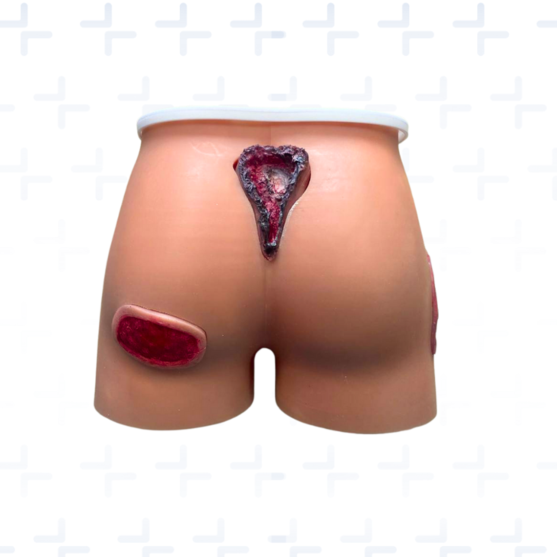 Simulador región sacra y glúteos con lesiones por presión  1