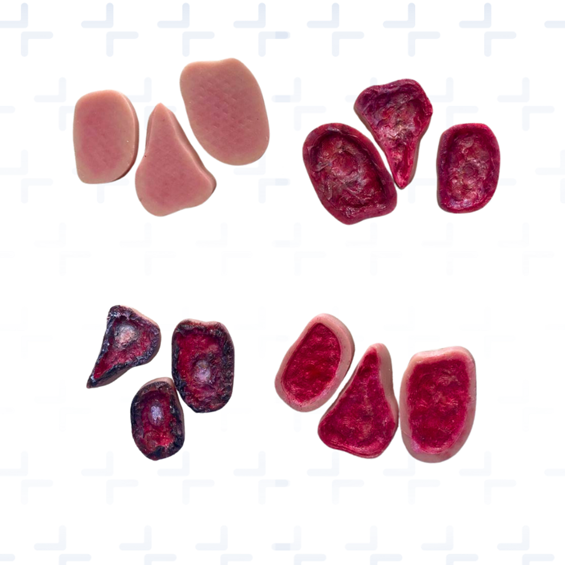 Simulador región sacra y glúteos con lesiones por presión  3