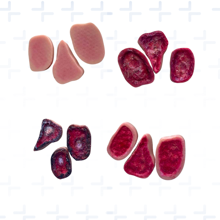 Simulador región sacra y glúteos con lesiones por presión  3