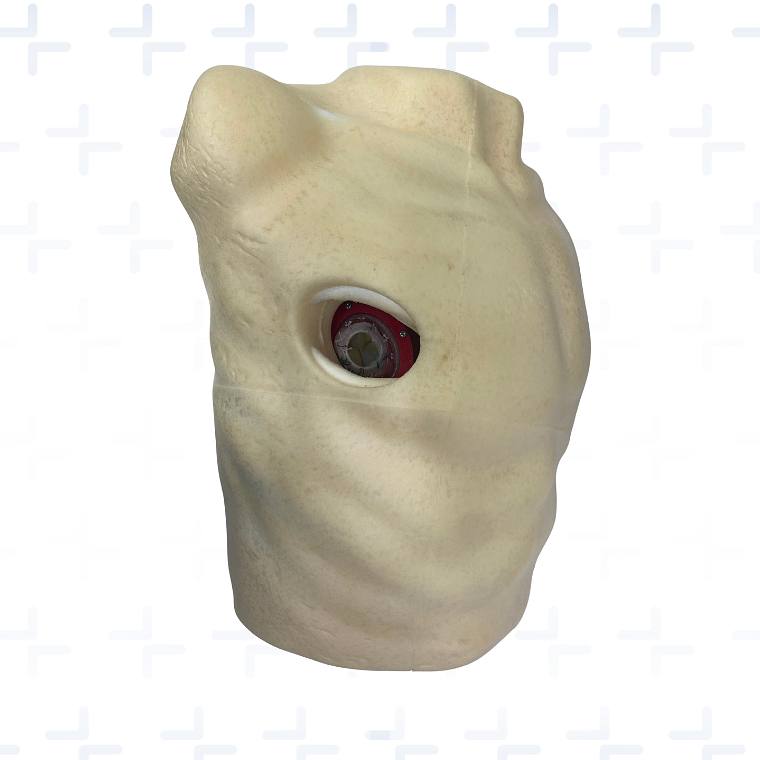 Simulador para reemplazo valvula mitral por visión directa 1