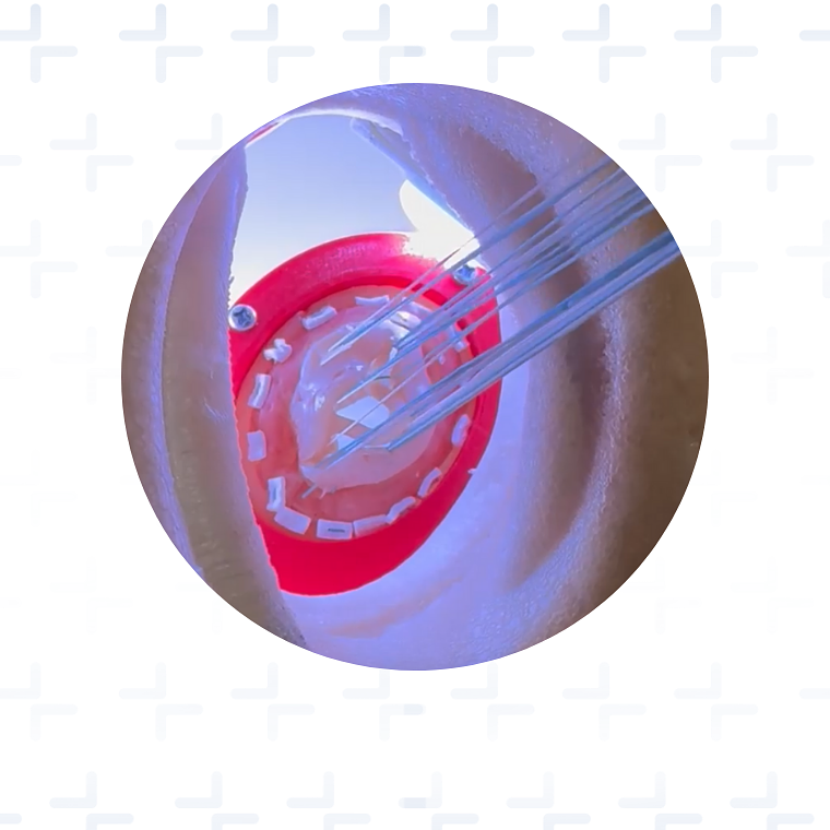 Simulador para reemplazo valvula mitral por visión directa 2