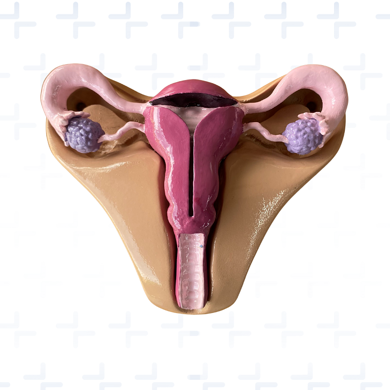 Simulador de colocación de DIU 1