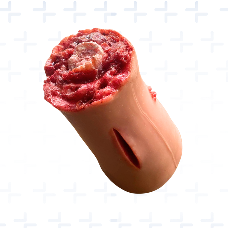 Simulador Muslo Control de Hemorragias 2