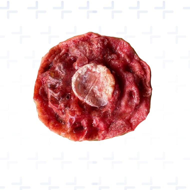 Simulador Muslo Control de Hemorragias 3