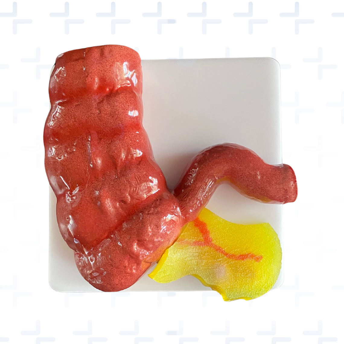 Plataforma laparoscopica para apendicectomia 1