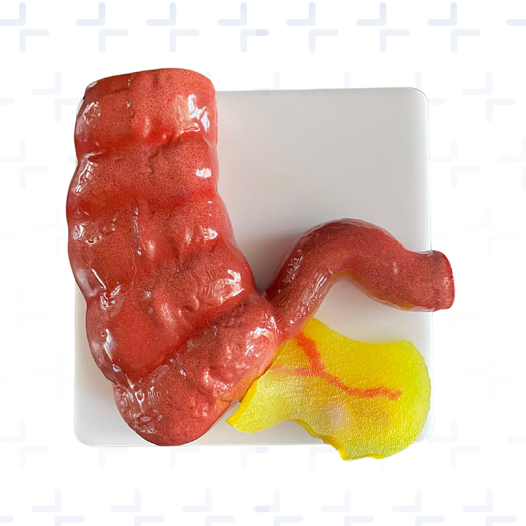 Plataforma laparoscopica para apendicectomia 1