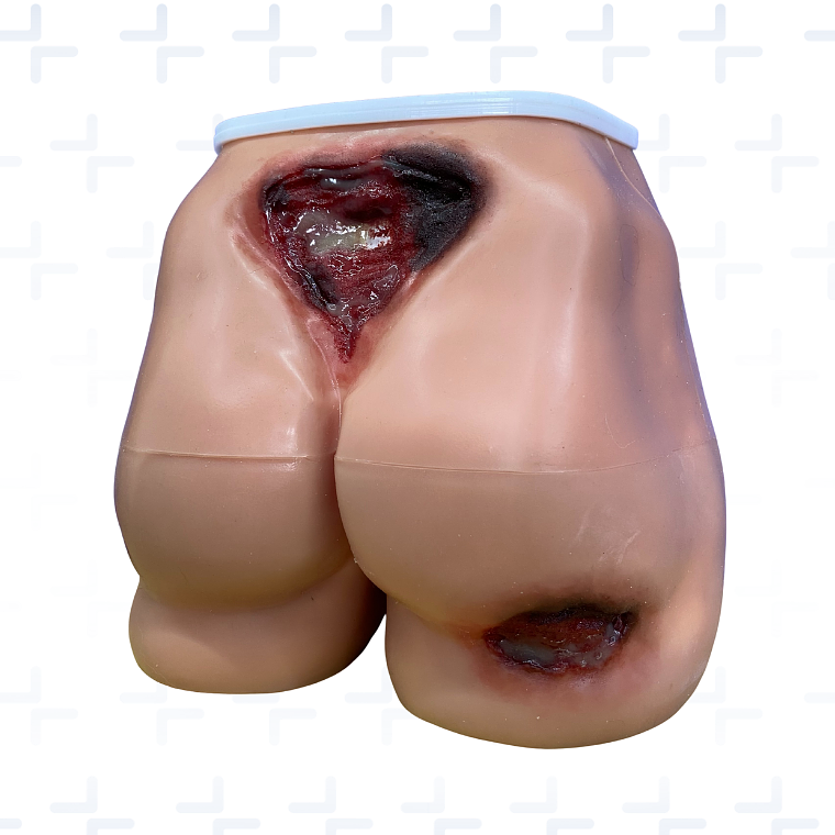 Simulador región sacra y glúteos con lesiones por presion fijas 2