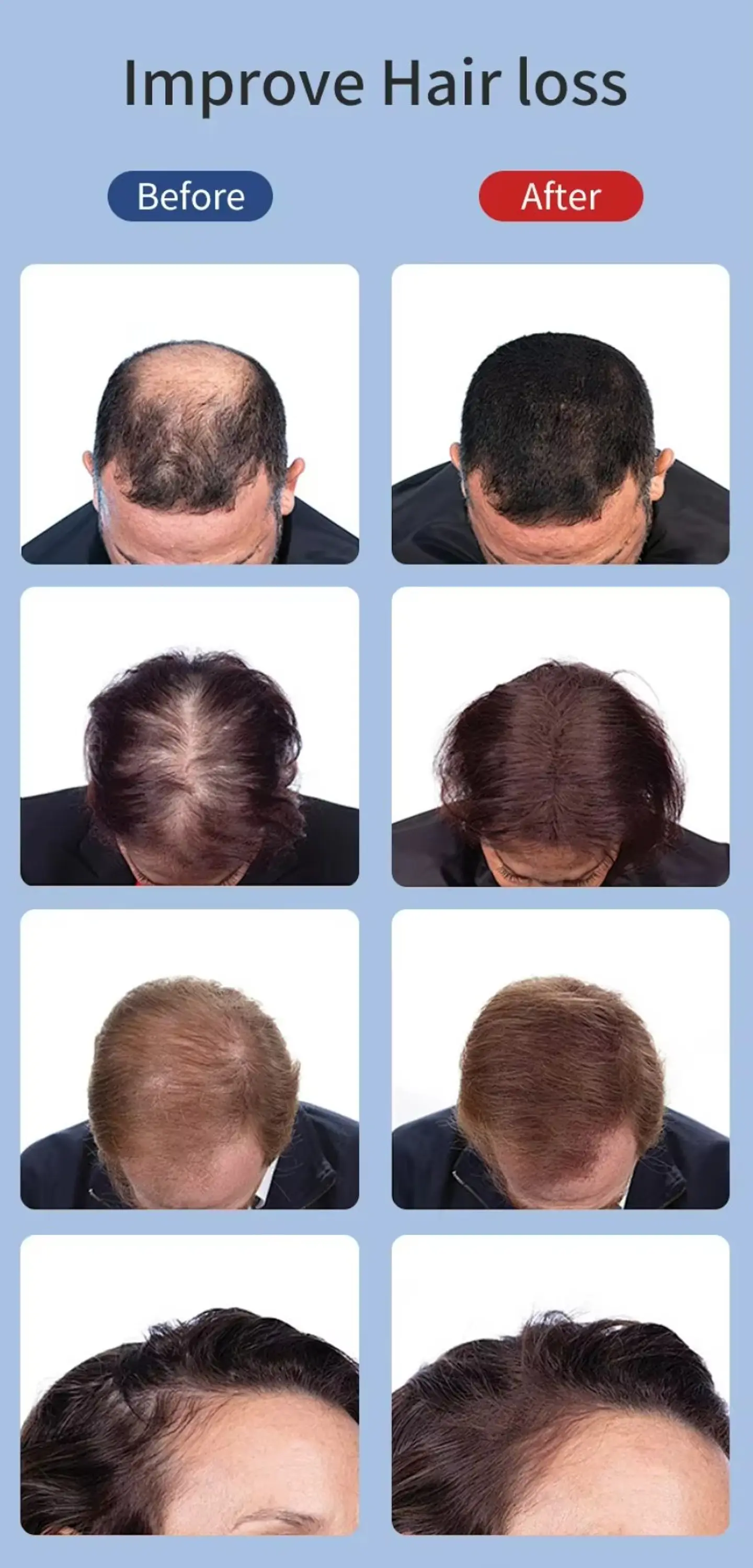 Terapia de Luz Roja Infrarroja 850nm para Cabello + Esencia de Menta | Cuidado Capilar InnovaTek 3