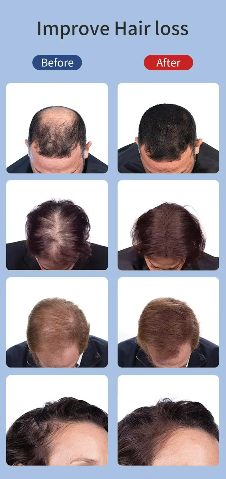 Terapia de Luz Roja Infrarroja 850nm para Cabello + Esencia de Menta | Cuidado Capilar InnovaTek 3