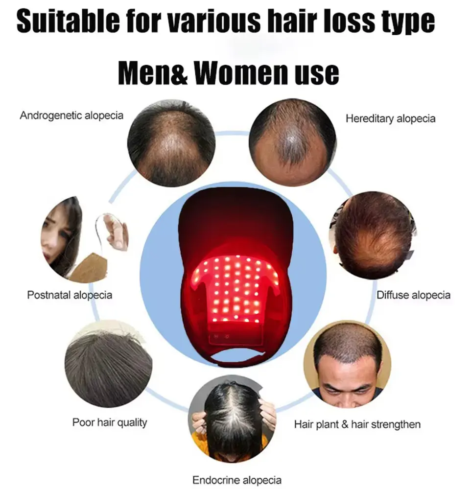 Terapia de Luz Roja Infrarroja 850nm para Cabello + Esencia de Menta | Cuidado Capilar InnovaTek 4