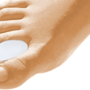 Separador de Dedos de Carrete con Anillo – DeRoyal