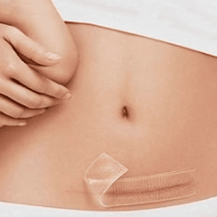 Parche de Silicona para Cicatrices