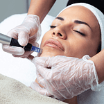 Dermapen Rostro 3 Sesiones