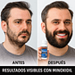 Minoxidil Kirkland + Dermarroller Crecimiento de Barba y Cabello tratamiento 1 Mes 60 ML - Miniatura 5
