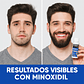 Minoxidil Kirkland + Dermarroller Crecimiento de Barba y Cabello tratamiento 1 Mes 60 ML - Miniatura 8