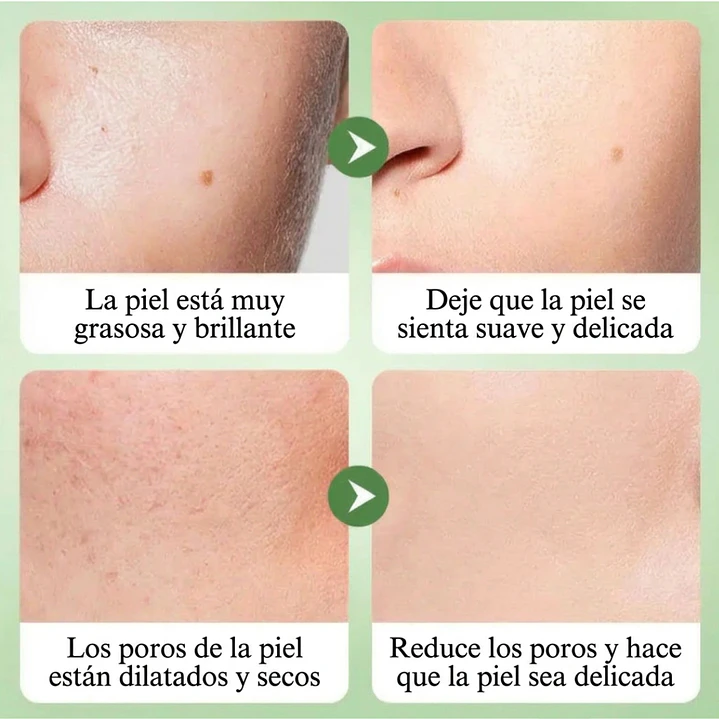 Kit Facial Bioaqua De Centella Asiática Para Pieles Grasas o Con Acné  3