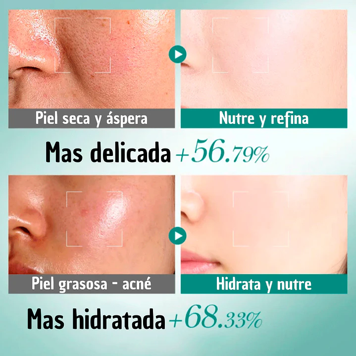 Kit Facial Bioaqua De Acido Hyalurónico 3