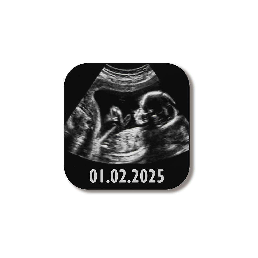 Íman com Fotografia e Frase - 5cm 1