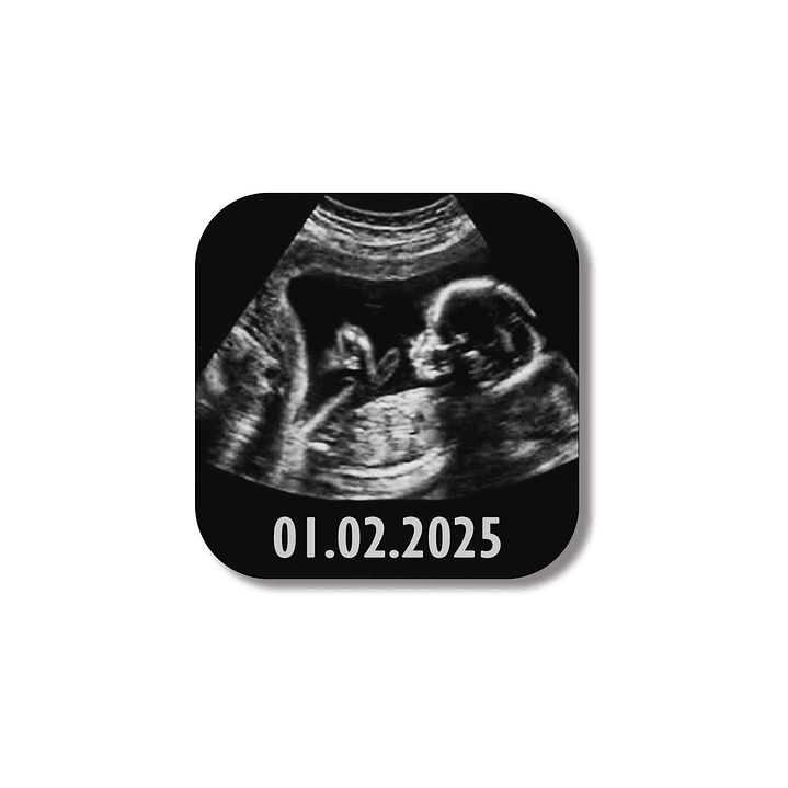 Íman com Fotografia e Frase - 5cm 1