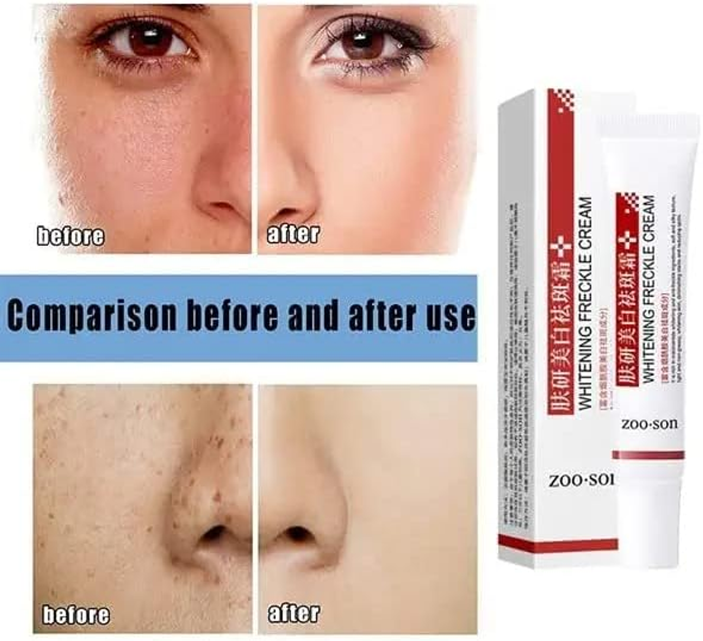 Anti- Freckle Whitening Cream 2