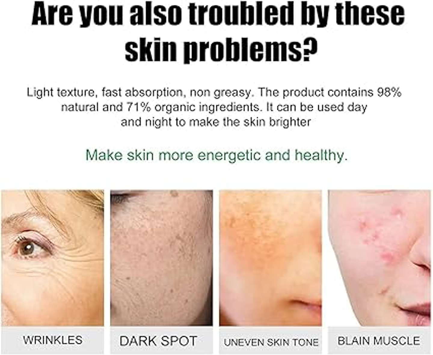 Anti- Freckle Whitening Cream 3