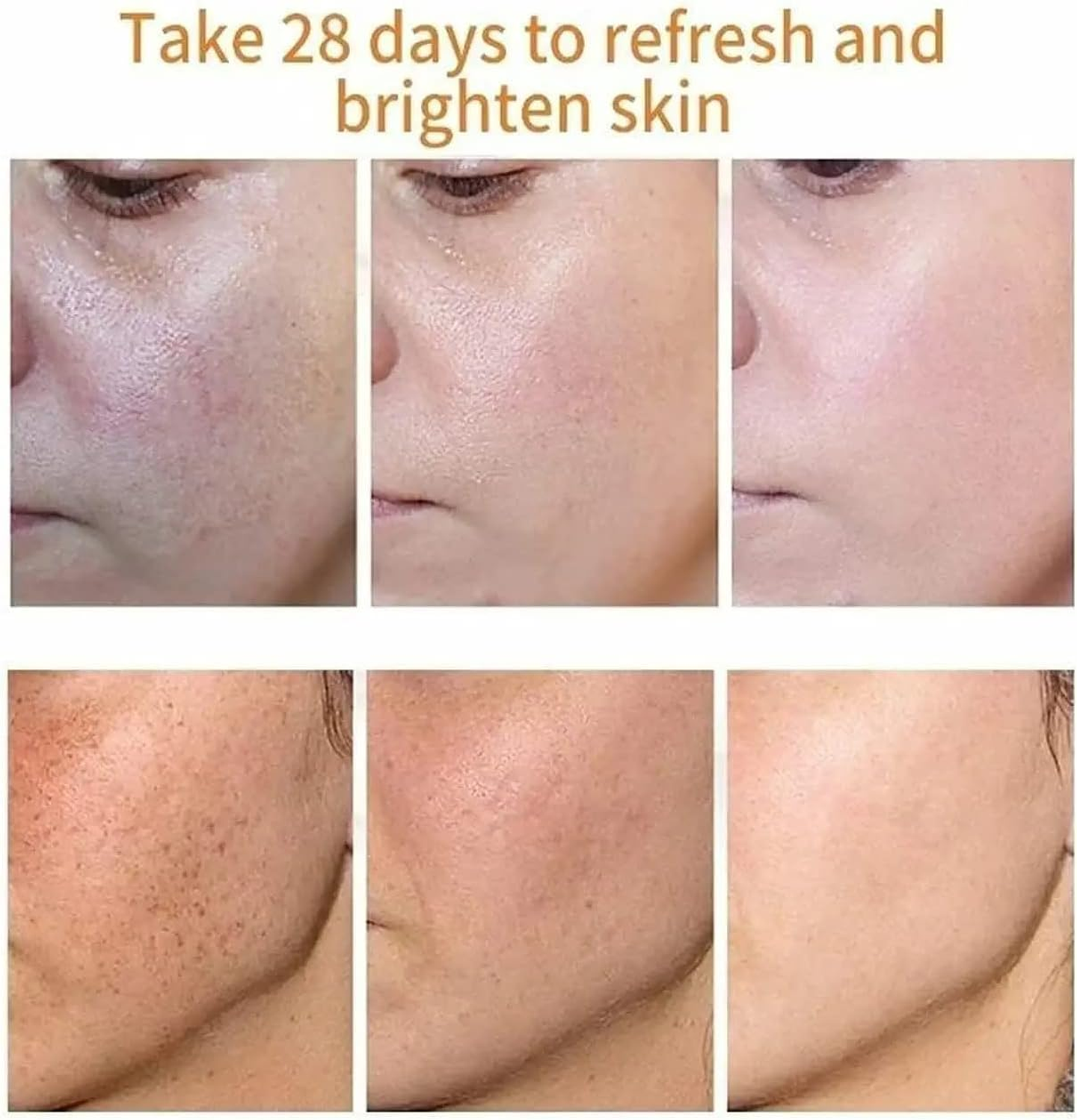 Anti- Freckle Whitening Cream 4