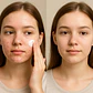 ZOO·SON® Dark Spot Corrector & Brightening Cream – Target Hyperpigmentation & Melasma - thumbnail 2