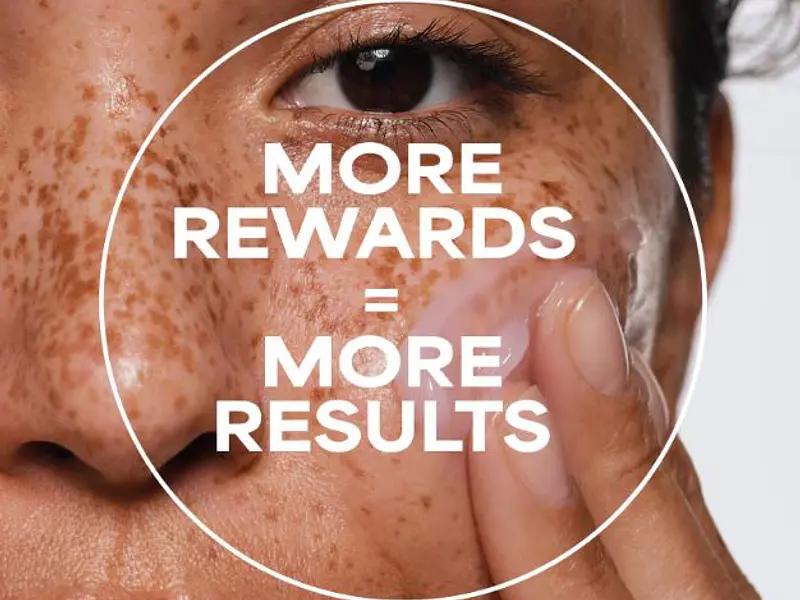 What Causes Hyperpigmentation and Melasma?
