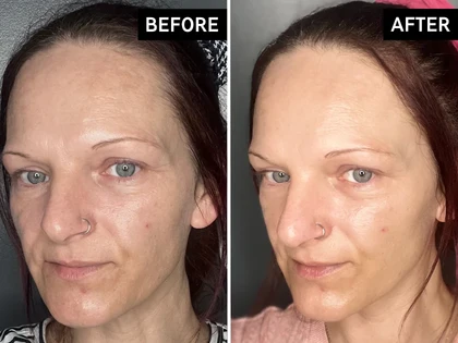 ZOO-SON Ceramide Yeast Moist 5-Piece Set Review: Secret to Glass & Radiant Skin