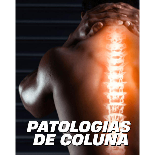 E-book Patologias da coluna - conhece, previne e cuida