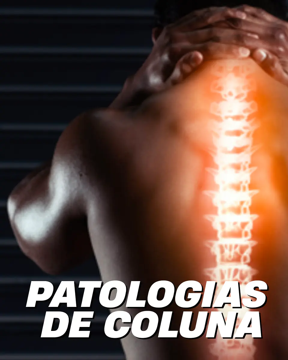 E-book Patologias da coluna - conhece, previne e cuida 1