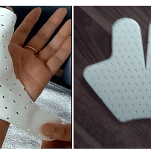 INMOVILIZADOR DE PULGAR (TIPO ESPINA DE PESCADO) TERMOPLÁSTICO PRECORTADO LISTO PARA MOLDEAR