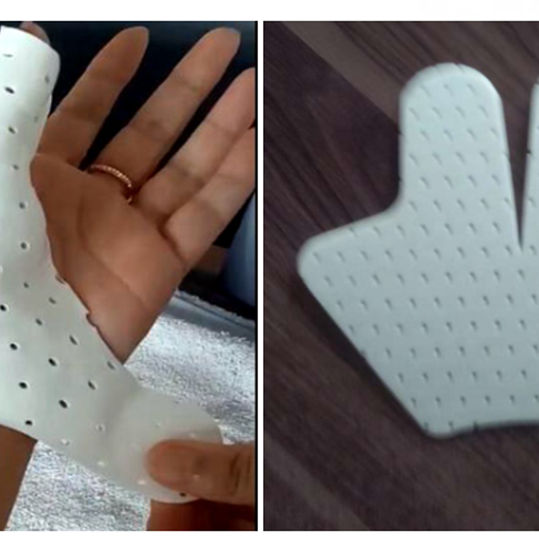 INMOVILIZADOR DE PULGAR (TIPO ESPINA DE PESCADO) TERMOPLÁSTICO PRECORTADO LISTO PARA MOLDEAR 1