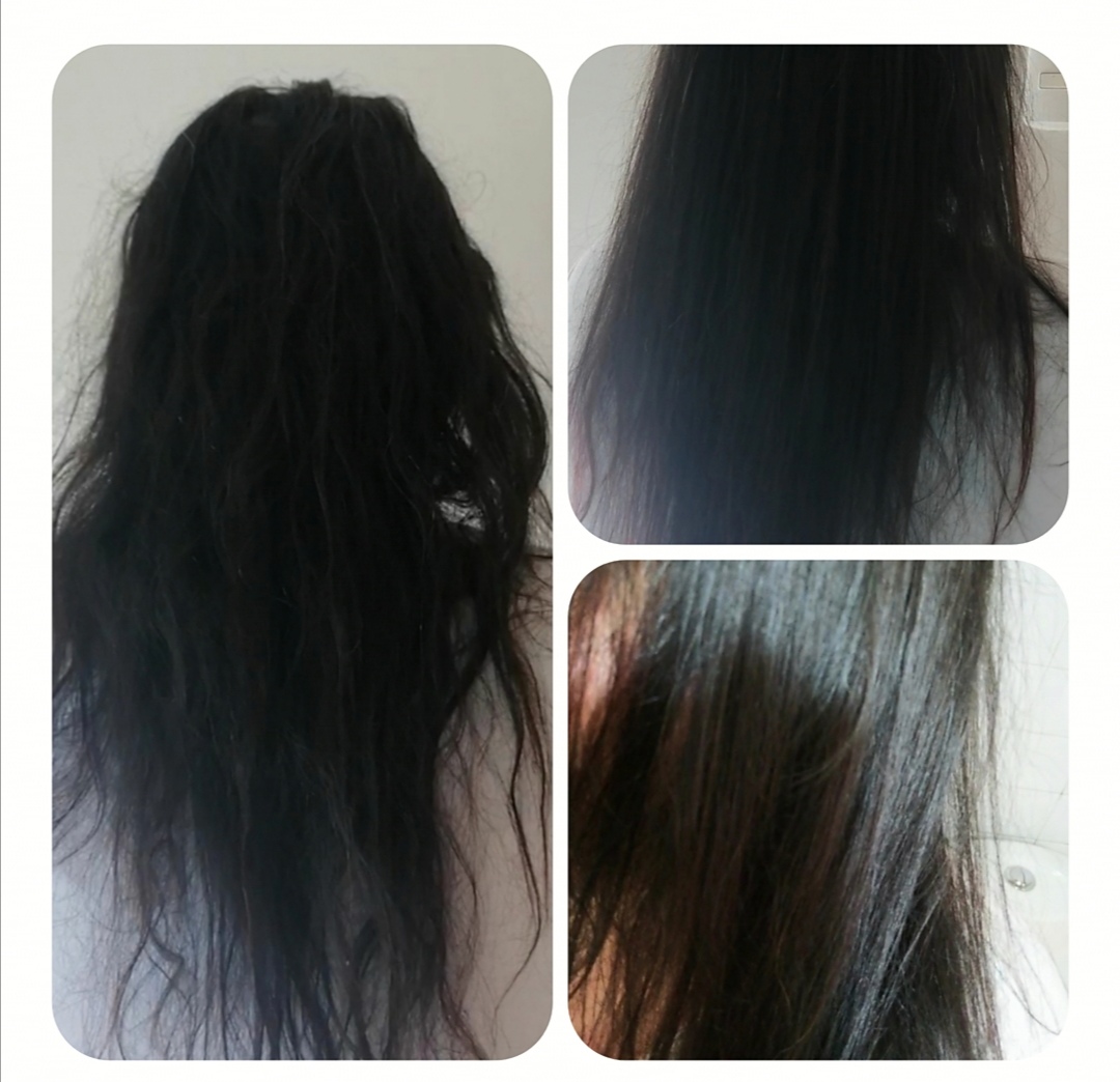 Kit Anti Caspa 500ML  3