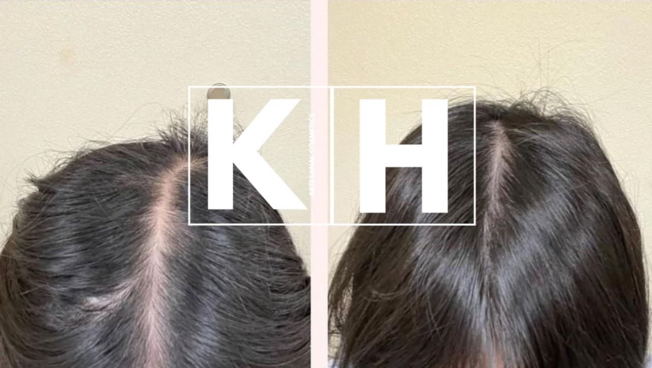 SUPER KIT Anti caída Envío gratis 500ML 2