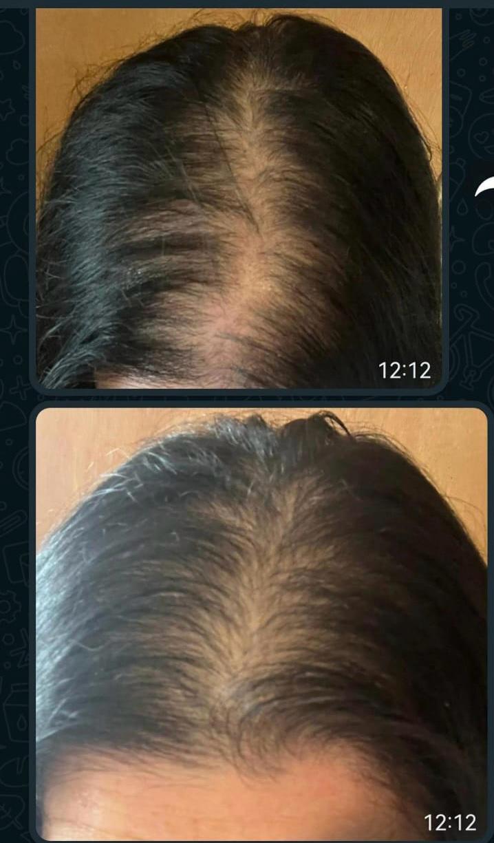 KIT Cebolla crecimiento XXL Envío gratis 500ML 2