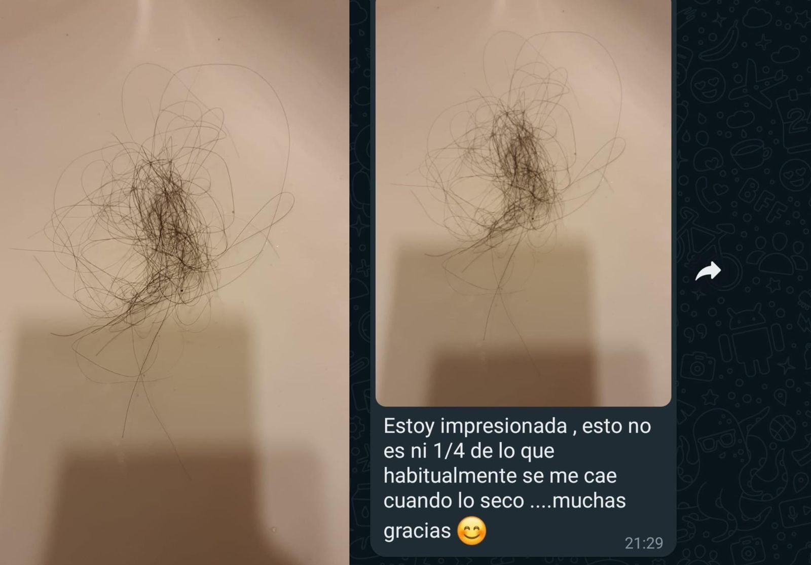 Kit Anti Caída 500ML 2