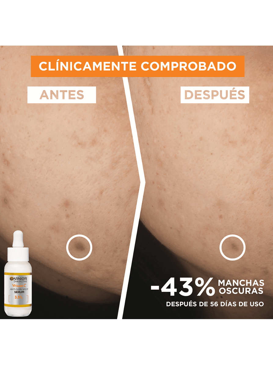 Serum Garnier Express Aclara Anti Manchas Vitamina C 3