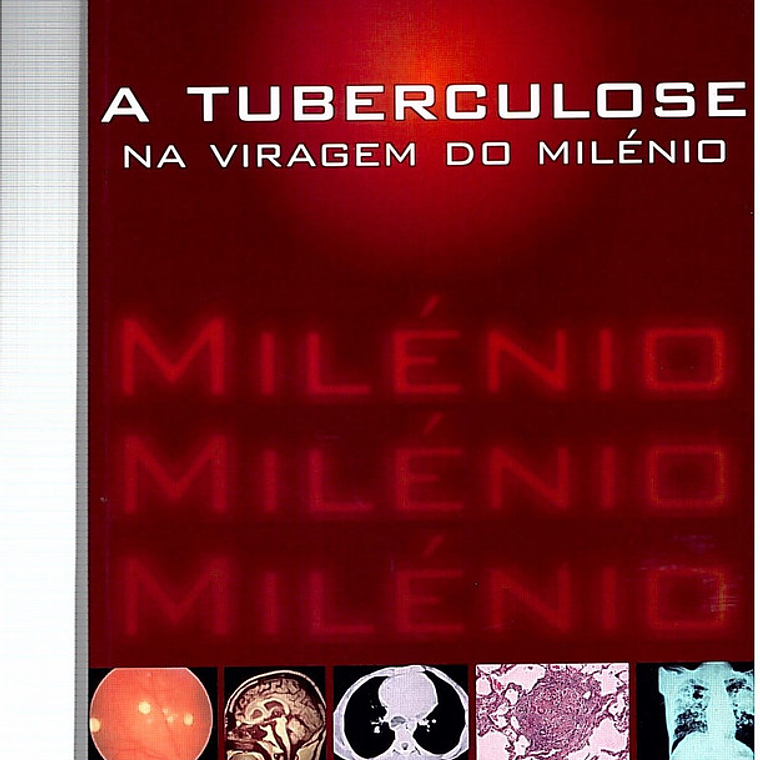 A tuberculose na viragem do milénio 1