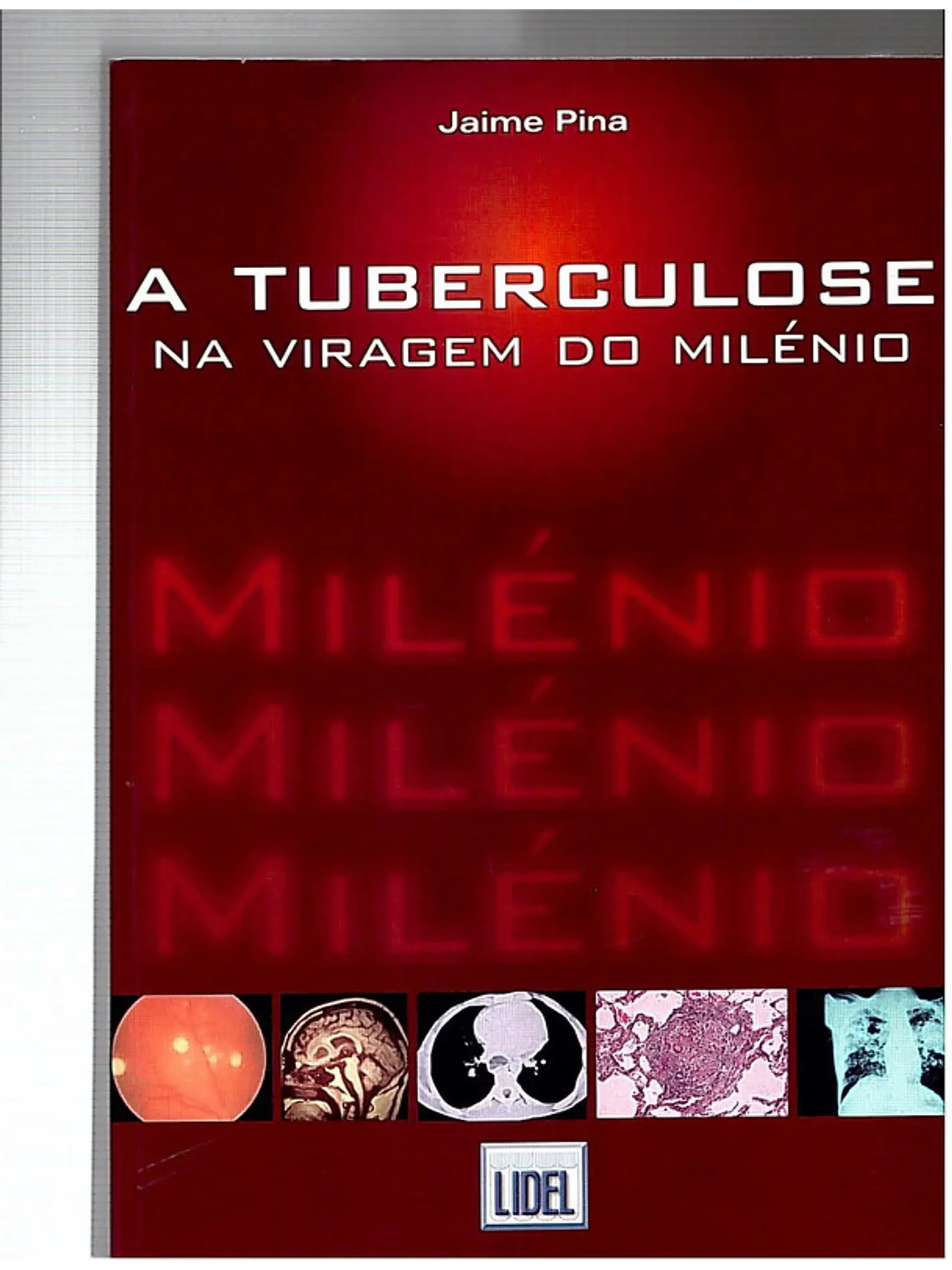 A tuberculose na viragem do milénio 1